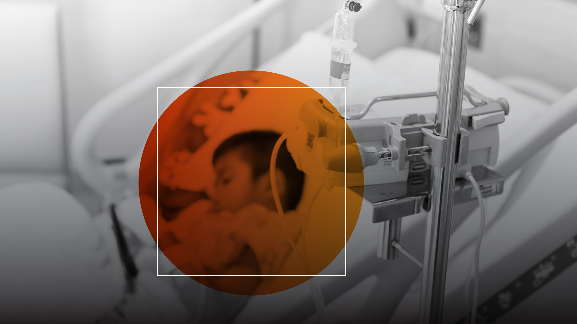 A child lays in a hospital bed receiving treatment through an IV.